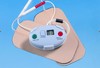 OVA- mini elektrostimulator OVA- mini elektrostimulator