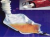 Daylite tømbar urinoppsamlingspose /flaske.  - eksempel fra produktgruppen urinoppsamlingsposer med ende for tømming, ikke kroppsbårne